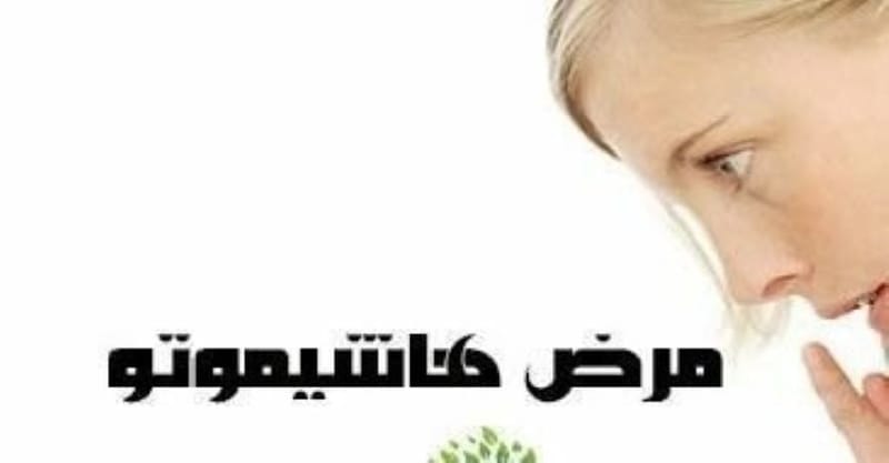 #الأجسام_المضادة_الغدة_الدرقية
#مرض_هاشيموتو
#خمول_كسل_الغدة_الدرقية