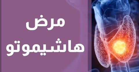 #الأجسام_المضادة_الغدة_الدرقية#مرض_هاشيموتو#الحملم