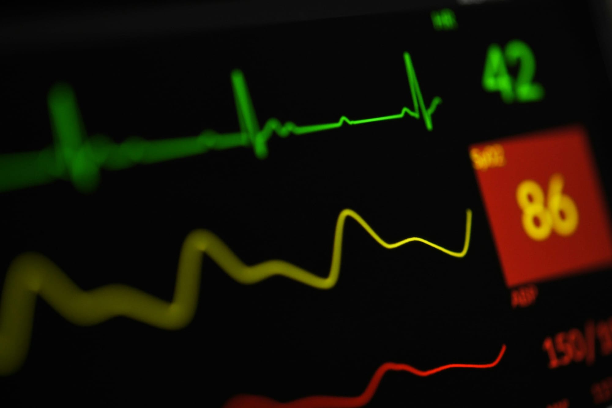Variabilité cardiaque et apnée : un dialogue entre cœur et souffle