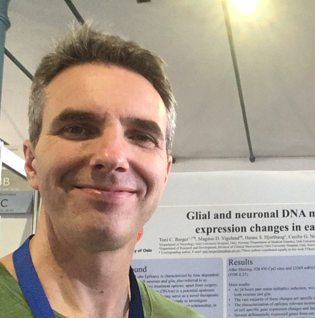 8,3 mill til forskning på KI-basert "brems" mot epileptiske anfall