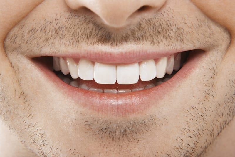 ש.ל.ה - חברת ש.ל.ה: כללית סמייל עם כל מה שרציתם לדעת על ציפויי שיניים - נוף הגליל