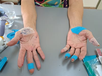 טיפול בחרדות ופחד לצאת מהבית