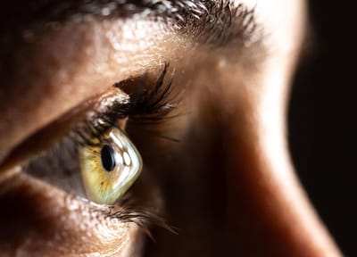 Laser et Kératocone