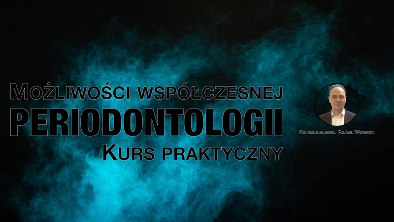 Możliwości współczesnej periodontologii