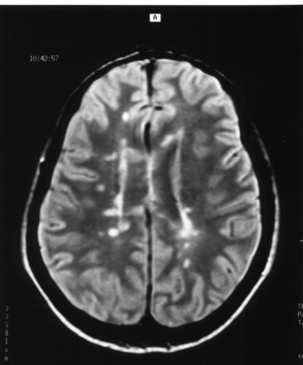 An external file that holds a picture, illustration, etc. Object name is ClinMedRes0101-0057Fig1B.jpg