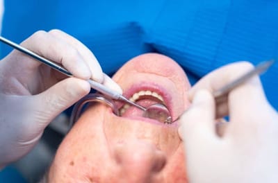 Family Dental Wellness and Emergency Support in Clementi