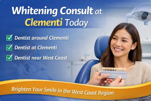 Clinical Tooth Whitening Guide