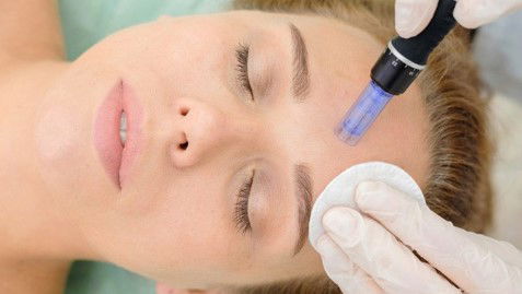 Collagen Induction Therapy