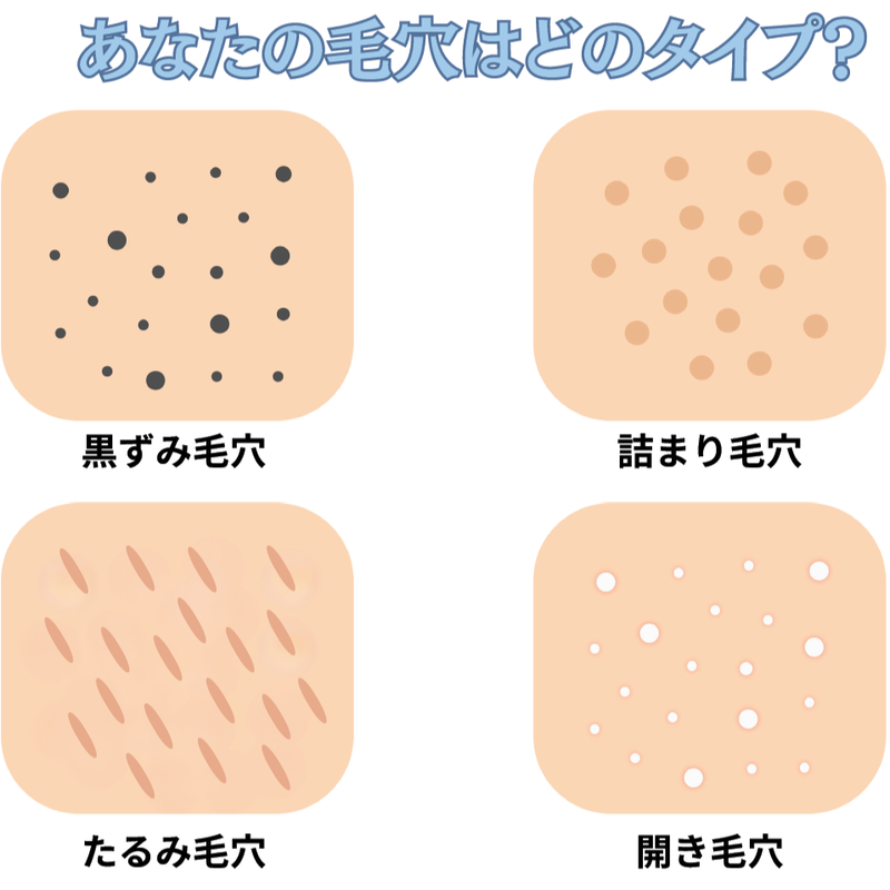 【美肌通信´25.8】鬼滅の刃無限城編公開！夏の毛穴対策