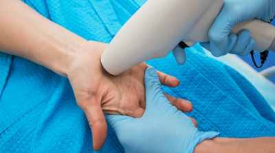 طرق علاج فرط التعرق