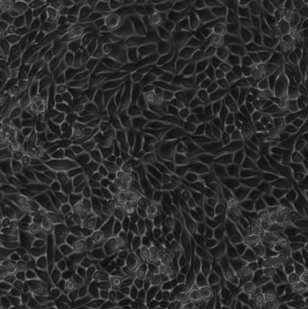 Statistical Properties of Individual Cell Trajectories Within a Monolayer of Human Bronchial Epithelial Cells