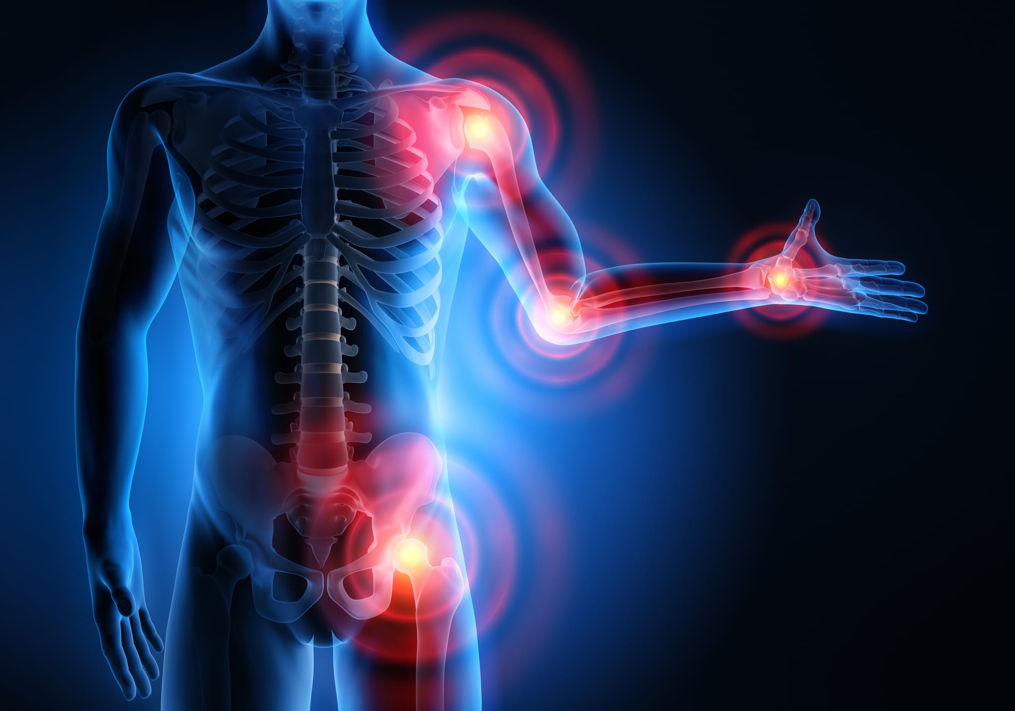 Nutrition Tips to Support Mobility and Joint Health