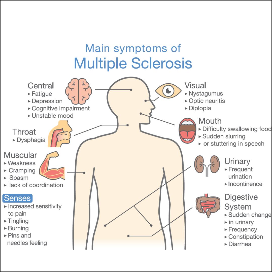 Exploring the Potential Benefits of Hyperbaric Oxygen Therapy for Multiple Sclerosis