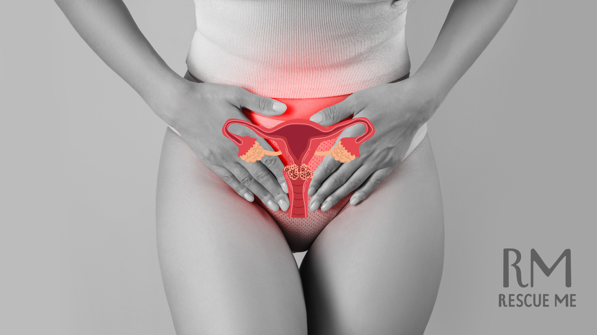 CBD y THC para el dolor de endometriosis