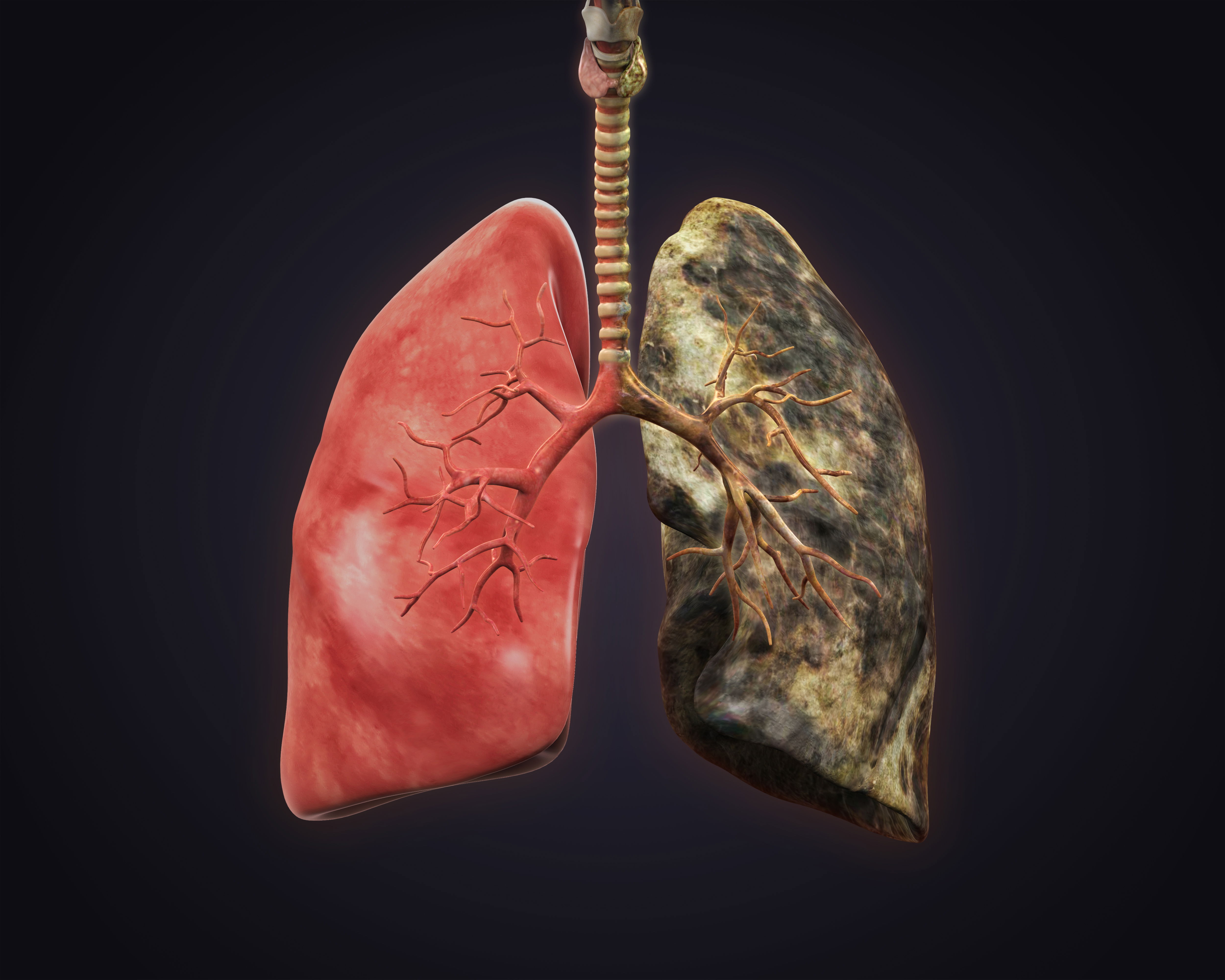 diseased lungs next to healthy lungs