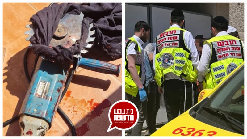 רחוב ירמיהו הנביא: גבר בן 41 נפגע מדיסק חשמלי - מצבו בינוני