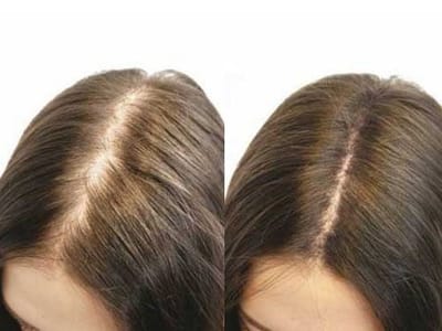 How Sea Water, Silicone, and Dead Hair Follicles Impact Your Hair Health