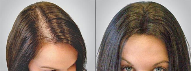 Benefits of Sunlight for Hair Growth: