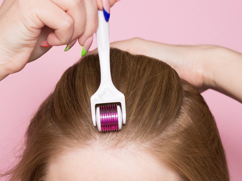 Dermastamp: The Ultimate Tool for Hair Growth