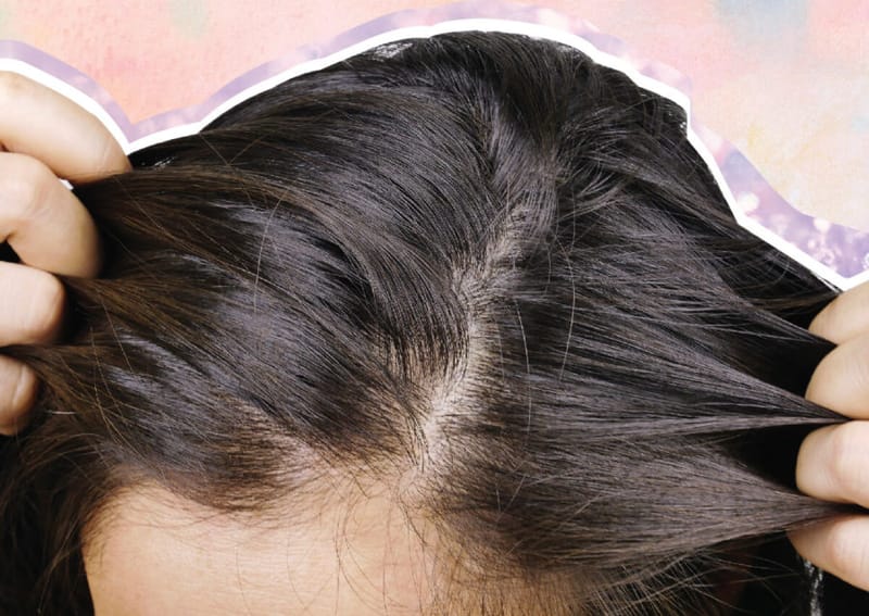Unlock the Secrets of Healthy Hair: Dermastamp, Sunlight, and Hair Regrowth