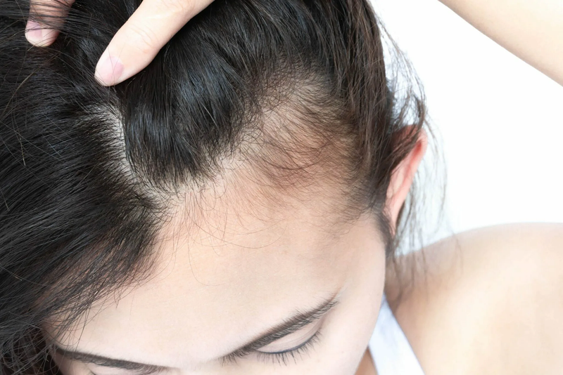 How Sea Water, Silicone, and Dead Hair Follicles Impact Your Hair Health