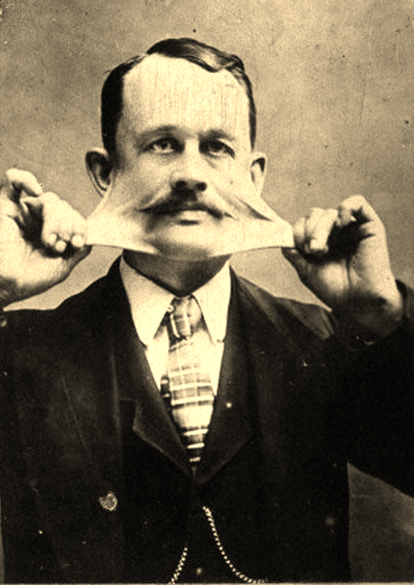 4 : Les corps déformés ou singuliers