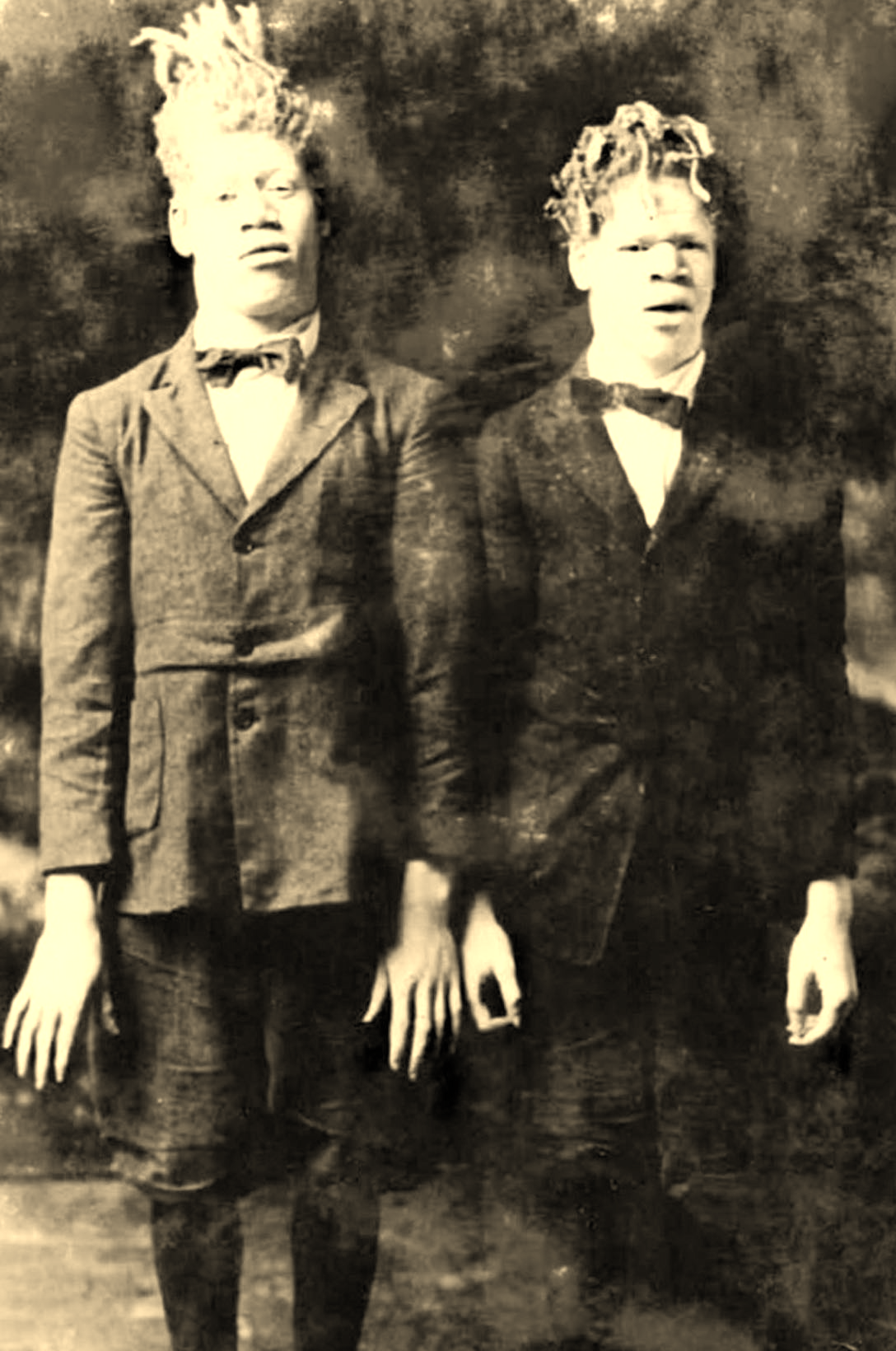 7 : Les singularités de peau et de couleur