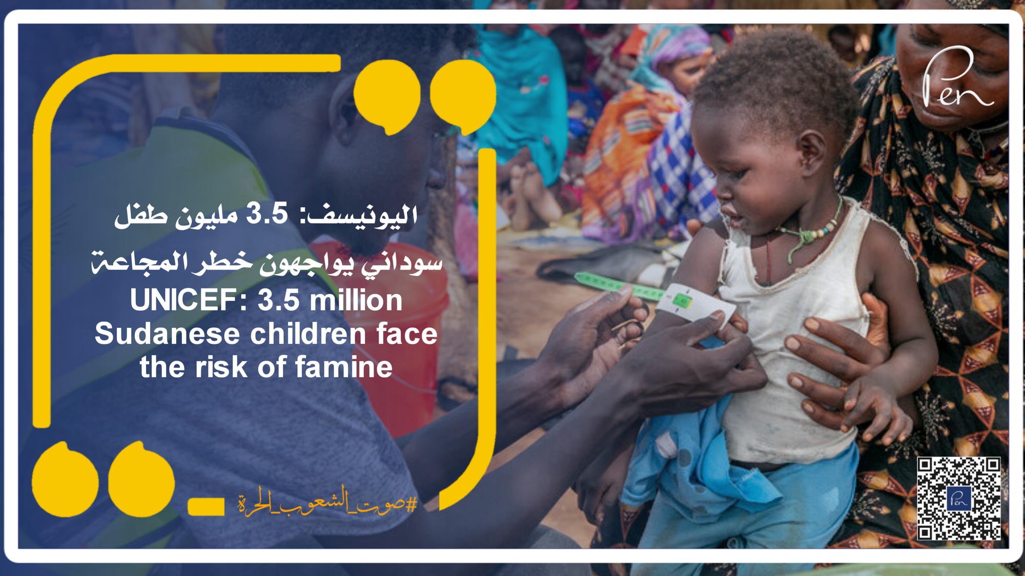 UNICEF: 3.5 million Sudanese children face the risk of famine