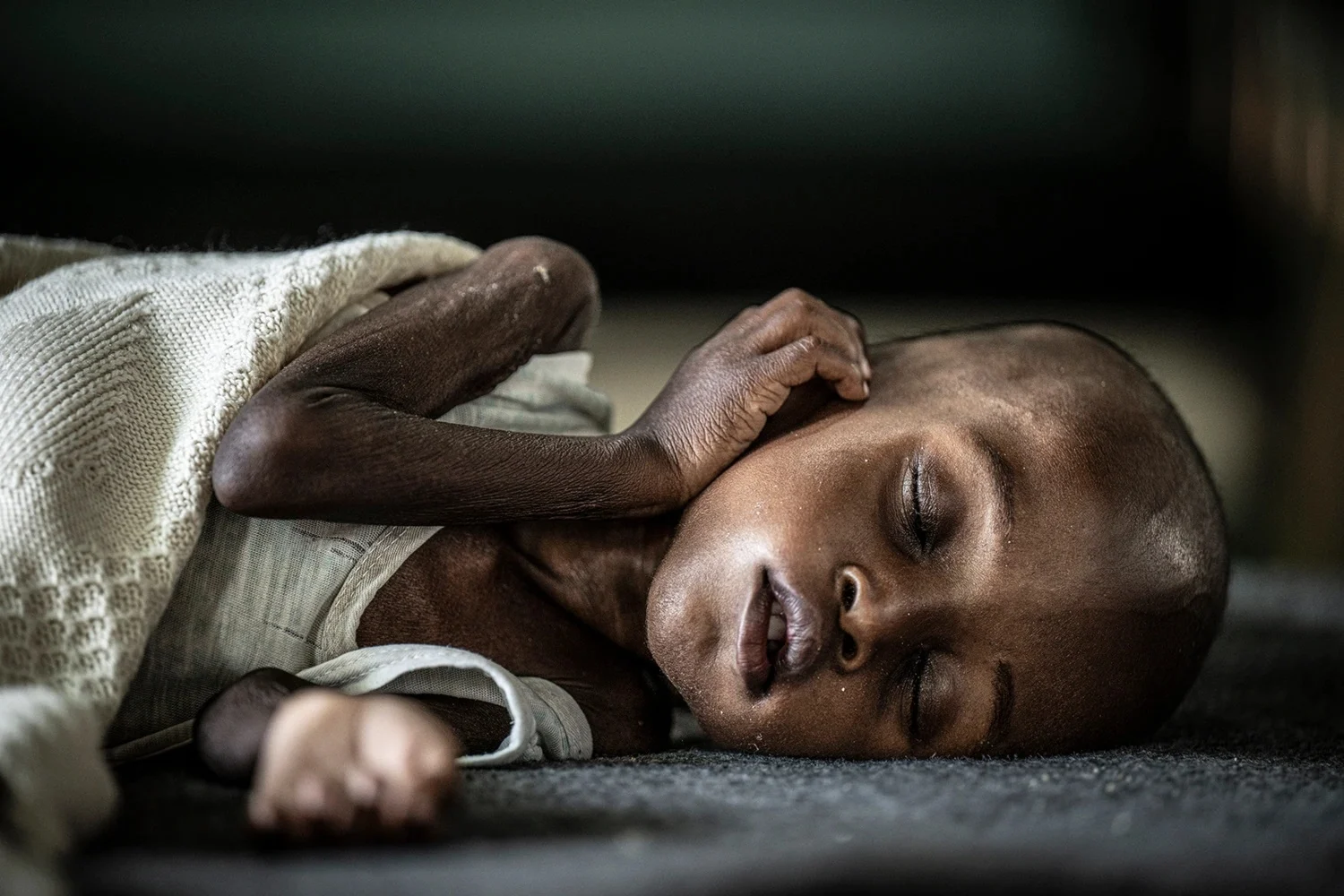 اليونيسف: الأطفال في السودان "تحولوا إلى جلد على عظم"