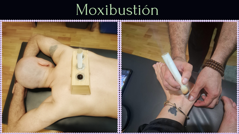 Moxibustión