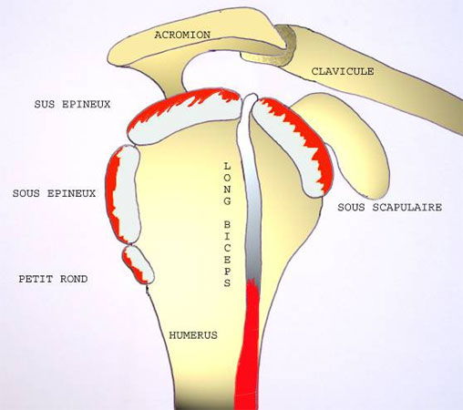 tendon épaule