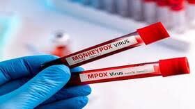 جدري القردة يتسلل إلى أكبر دولة سكانيا