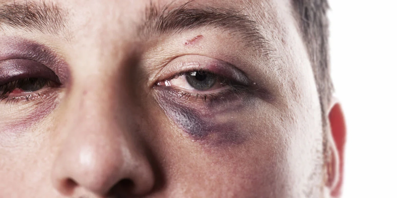 ارتفاع حاد للعنف ضد الرجال في إقليم كردستان خلال 2025