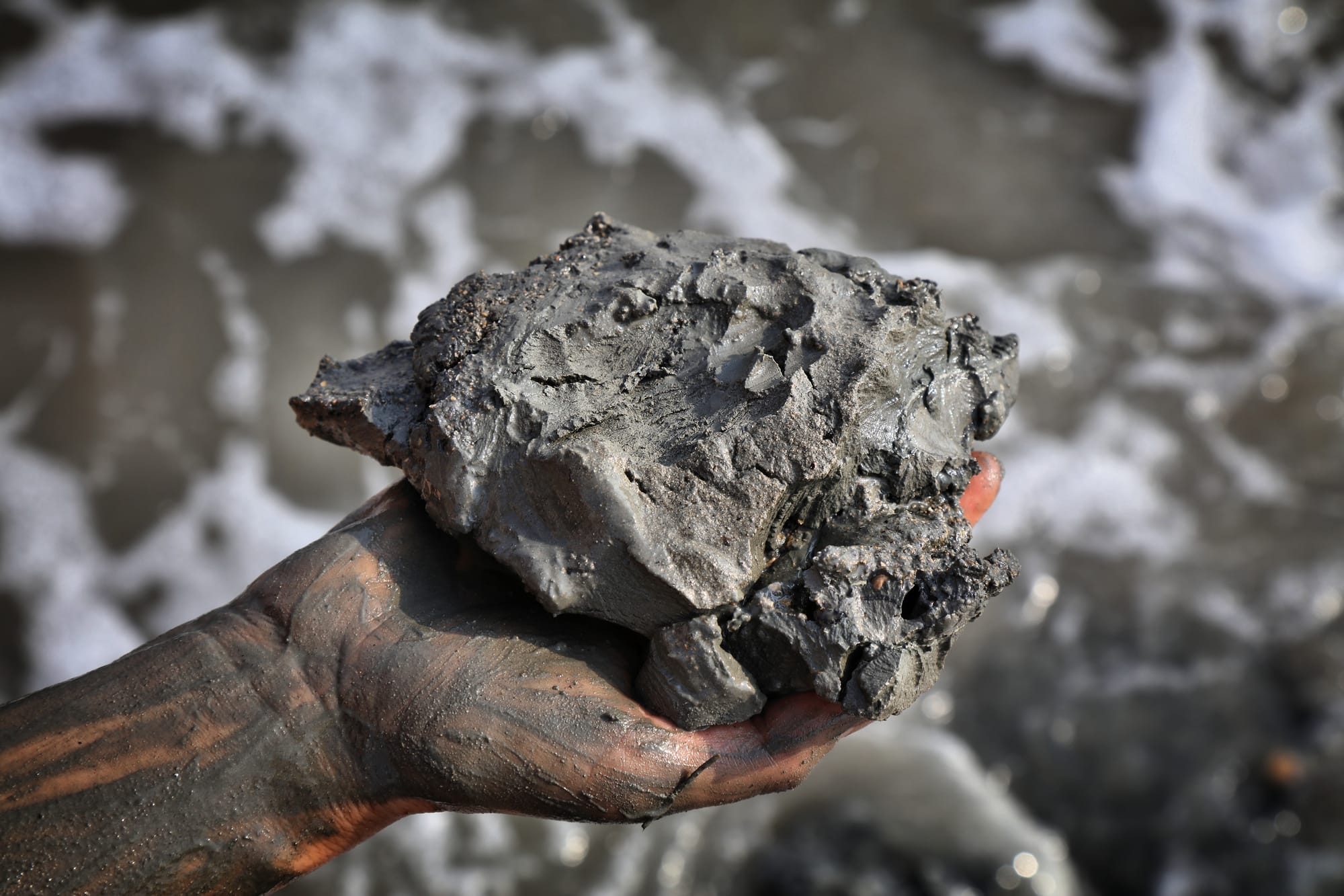 בוץ ומלח מים המלח, מתי זה טיפול מצוין ומתי זה עלול להחמיר