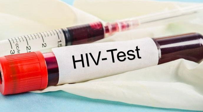 عقار ثوري للوقاية من الإيدز