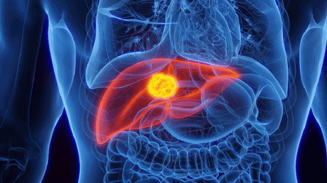 اكتشاف هام في مجال تطوير لقاحات السرطان.