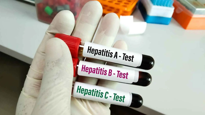 وسط أرقام مقلقة.. خطة مغربية للحد من الوفيات بالتهاب الكبد الفيروسي