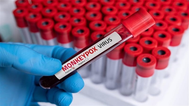 مصر تكشف حقيقة اكتشاف إصابات بـ"جدري القردة"