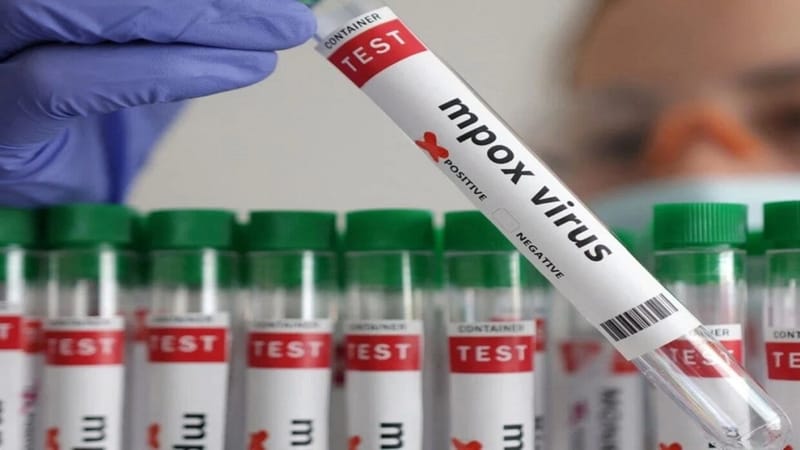 متغير جدري القردة الجديد يصل إلى ألمانيا بعد السويد