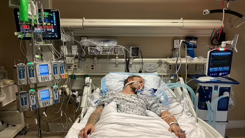 على طاولة الجراحة.. الكشف عن تفاصيل عودة جثة أمريكي إلى الحياة قبل استئصال أعضائها