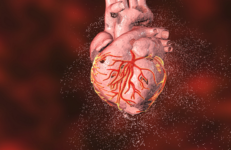 من هم الأكثر عرضة للموت القلبي المفاجئ؟