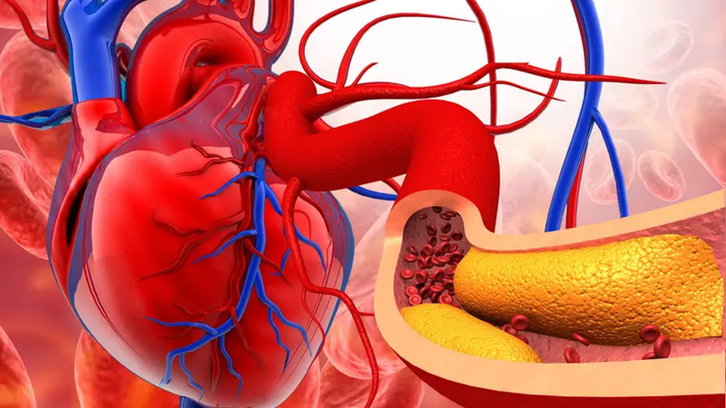تقنية جديدة لفحص شرايين القلب دون تدخل معقد