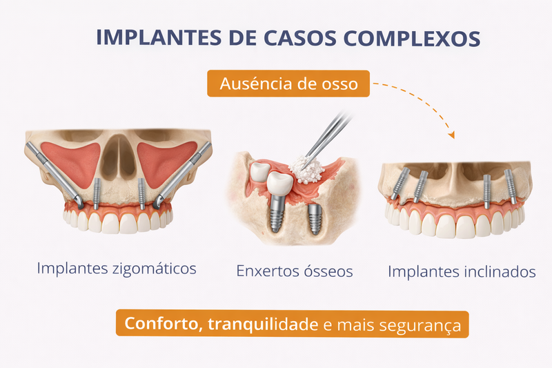 🧠 IMPLANTES EM CASOS COMPLEXOS