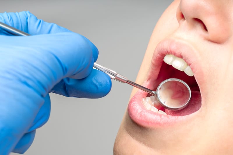 Dental Care - Affordable or Free