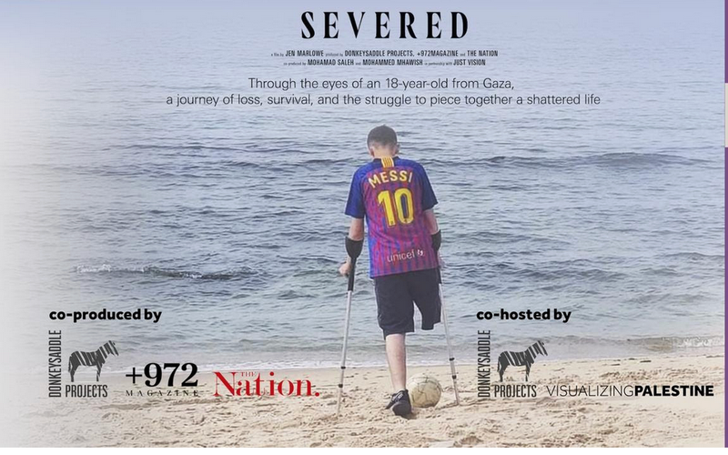 Documentary film: Severed & panel discussion on disability justice in Palestine