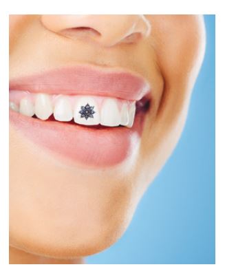 Modifiche dentali estetiche: tra tendenza e rischi per la salute orale delle dental modification