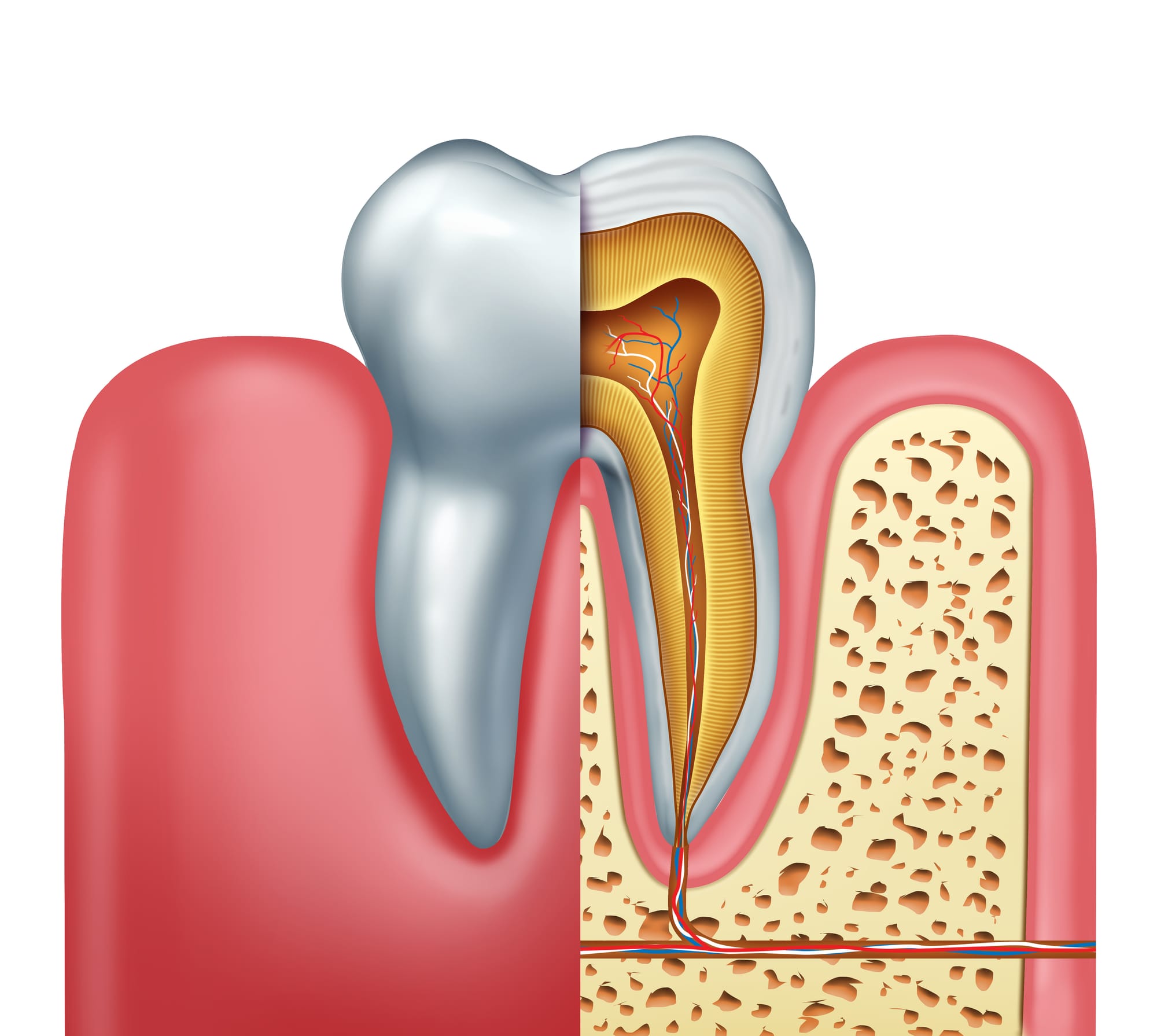 Root canal treatment