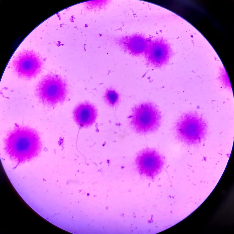 Sperm DNA