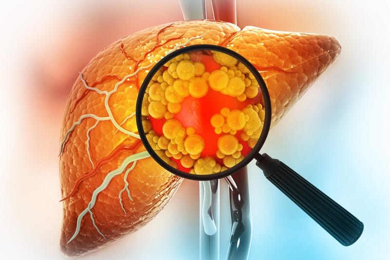 Scientists Eradicate Liver Tumors in Mice by Inhibiting Key Immune Regulator
