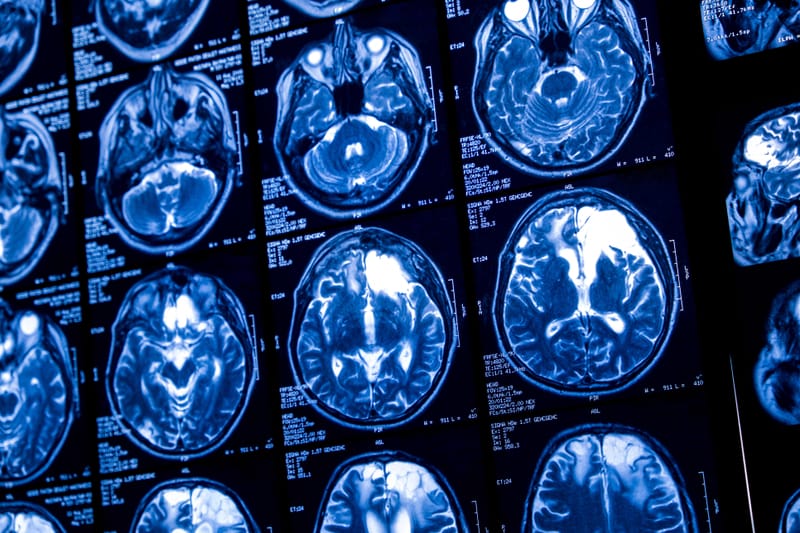 High-Performance MRI Scanner Developed to Unlock Brain’s Microscopic Secrets